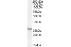 Image no. 2 for anti-Cysteine and Glycine-Rich Protein 2 (CSRP2) (Internal Region) antibody (ABIN374898) (CSRP2 抗体  (Internal Region))