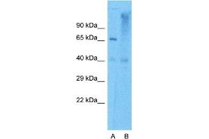 Western Blotting (WB) image for anti-Aconitase 1 (ACO1) (N-Term) antibody (ABIN2778793)
