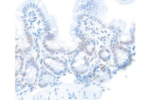 Immunohistochemistry (IHC) image for anti-Replication Protein A2, 32kDa (RPA2) (pSer4), (pSer8) antibody (ABIN7449013)