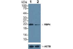 Western blot analysis of (1) Wild-type HepG2 cell lysate, and (2) RBP4 knockout HepG2 cell lysate, using Rabbit Anti-Cow RBP4 Antibody (1 µg/ml) and HRP-conjugated Goat Anti-Mouse antibody ( (RBP4 抗体  (AA 19-201))