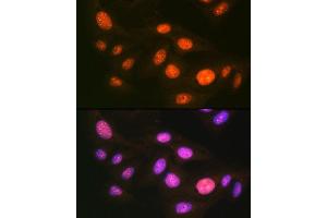 Immunofluorescence analysis of U-2 OS cells using UB Rabbit mAb (ABIN7271185) at dilution of 1:100 (40x lens). (UBA1 抗体)