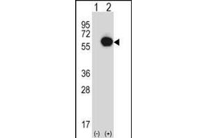 Western blot analysis of RANG (arrow) using rabbit polyclonal RANG Antibody (N-term) 3776a. (RANGAP1 抗体  (N-Term))