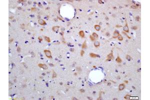 Formalin-fixed and paraffin embedded rat brain labeled with Rabbit Anti-HES6 Polyclonal Antibody, Unconjugated (ABIN1387271) at 1:200 followed by conjugation to the secondary antibody and DAB staining (HES6 抗体  (AA 1-80))