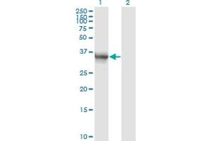 Western Blot analysis of AKR1B10 expression in transfected 293T cell line by AKR1B10 monoclonal antibody (M01), clone 1A6.