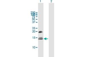 Western Blot analysis of CRB3 expression in transfected 293T cell line by CRB3 MaxPab polyclonal antibody. (CRB3 抗体  (AA 1-120))
