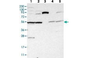 Western blot analysis of Lane 1: RT-4, Lane 2: U-251 MG, Lane 3: Human Plasma, Lane 4: Liver, Lane 5: Tonsil with SLC35F1 polyclonal antibody  at 1:250-1:500 dilution. (SLC35F1 抗体)