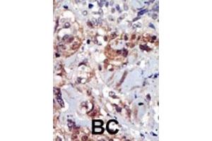 Immunohistochemistry (Paraffin-embedded Sections) (IHC (p)) image for anti-Phosphatidylinositol-5-Phosphate 4-Kinase, Type II, alpha (PIP4K2A) (AA 303-335), (C-Term) antibody (ABIN392598)
