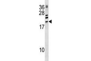 ATF3 antibody western blot analysis in CEM lysate. (ATF3 抗体  (AA 140-168))