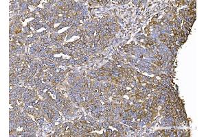 IHC analysis of IQGAP1 using anti-IQGAP1 antibody (ABIN7600509).