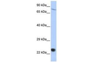 Image no. 1 for anti-SP110 Nuclear Body Protein (SP110) (AA 612-661) antibody (ABIN6742727) (SP110 抗体  (AA 612-661))
