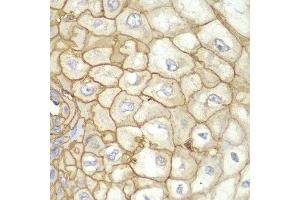 Immunohistochemistry (IHC) image for anti-Major Histocompatibility Complex, Class I, A (HLA-A) antibody (ABIN1873024)