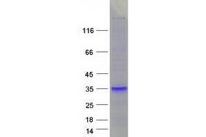Validation with Western Blot