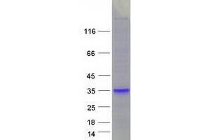 Validation with Western Blot (WFDC1 Protein (Myc-DYKDDDDK Tag))