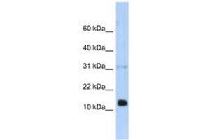 Image no. 1 for anti-Regenerating Islet-Derived 1 beta (REG1B) (N-Term) antibody (ABIN6740364) (REG1B 抗体  (N-Term))