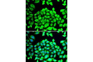 Immunofluorescence analysis of HeLa cell using CLCN7 antibody. (CLCN7 抗体)