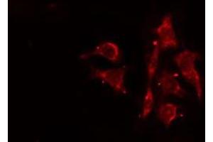 ABIN6276478 staining Hela cells by IF/ICC. (ACTR3 抗体  (C-Term))
