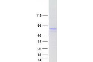 Western Blotting (WB) image for Checkpoint Kinase 1 (CHEK1) (Transcript Variant 3) protein (Myc-DYKDDDDK Tag) (ABIN2713978)