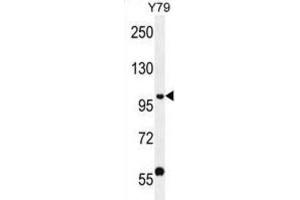 Western Blotting (WB) image for anti-PHD Finger Protein 20 (PHF20) antibody (ABIN2996558) (PHF20 抗体)