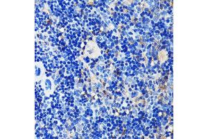 Immunohistochemistry of paraffin-embedded mouse spleen using GRB2 Rabbit mAb (ABIN7267518) at dilution of 1:100 (40x lens). (GRB2 抗体)
