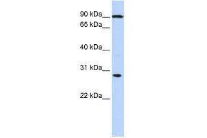 BOLL antibody used at 1 ug/ml to detect target protein. (BOLL 抗体)