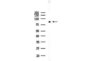 Western blot analysis of lysates from Rat testis, using PKC epsilon Antibody at 1/1000 dilution.