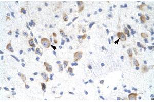 Human Brain; Rabbit Anti-GTF2F2 Antibody. (GTF2F2 抗体  (Middle Region))