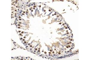 Immunohistochemistry (Paraffin-embedded Sections) (IHC (p)) image for anti-Small Nuclear Ribonucleoprotein D2 Polypeptide 16.5kDa (SNRPD2) antibody (ABIN7075634)