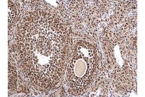 Immunohistochemistry (IHC) image for anti-Metastasis Associated 1 (MTA1) antibody (ABIN2854809)