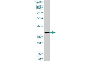 CDK4 monoclonal antibody (M09), clone 8A10. (CDK4 抗体  (AA 211-303))
