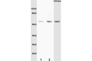 L1 mouse brain lysates L2 mouse embryo lysates probed with Anti Phospho-MEF2A (Thr312) Polyclonal Antibody, Unconjugated (ABIN743768) at 1:200 overnight at 4 °C.
