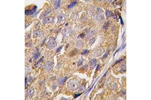 Immunohistochemistry (IHC) image for anti-Eukaryotic Translation Initiation Factor 4B (EIF4B) (AA 400-429) antibody (ABIN3028642)