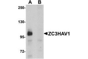 Western blot analysis of ZC3HAV1 in HeLa cell lysate with ZC3HAV1 antibody at 1μg/ml in (A) the absence and (B) the presence of blocking peptide. (ZC3HAV1 抗体  (C-Term))