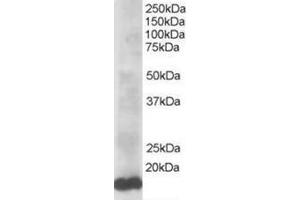 Image no. 1 for anti-Ubiquitin-Conjugating Enzyme E2L 3 (UBE2L3) (C-Term) antibody (ABIN374293) (UBE2L3 抗体  (C-Term))