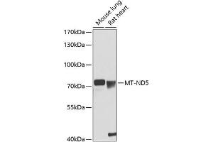 Western blot analysis of extracts of various cell lines, using MT-ND5 antibody (ABIN6135115, ABIN6144434, ABIN6144436 and ABIN6216103) at 1:1000 dilution.