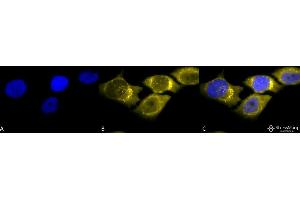 Immunocytochemistry/Immunofluorescence analysis using Rabbit Anti-SOD (Mn) Polyclonal Antibody . (SOD2 抗体  (Biotin))