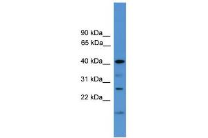 WB Suggested Anti-SCAMP1 Antibody Titration: 0. (SCAMP1 抗体  (Middle Region))