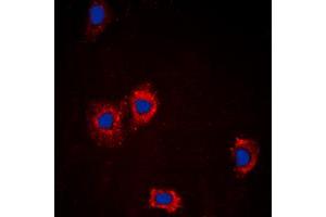 Immunofluorescent analysis of AKT staining in MCF7 cells. (AKT1 抗体  (Center))