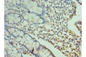 Immunohistochemistry of paraffin-embedded human small intestine tissue using ABIN7161084 at dilution of 1:100 (2B4 抗体  (AA 22-224))
