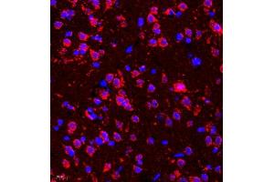 Immunofluorescence of paraffin embedded rat brain using deltex (ABIN7073794) at dilution of 1:200 (400x lens) (Deltex Homolog 1 抗体)