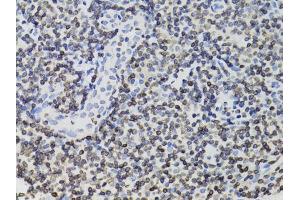 Immunohistochemistry of paraffin-embedded human tonsil using TMPO Antibody (ABIN1875122) at dilution of 1:100 (40x lens). (Thymopoietin 抗体)