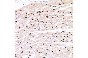 Immunohistochemical analysis of Cyclin E1 (pT77) staining in human heart formalin fixed paraffin embedded tissue section. (Cyclin E1 抗体  (pSer77))