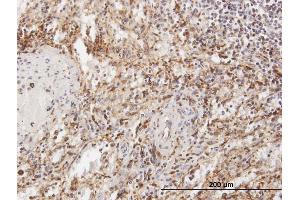 Immunoperoxidase of purified MaxPab antibody to TPP1 on formalin-fixed paraffin-embedded human spleen. (TPP1 抗体  (AA 1-563))