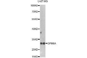 Western blot analysis of extracts of U-87MG cells, using GPM6A antibody (ABIN5995821) at 1/1000 dilution. (GPM6A 抗体)