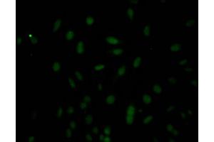 Immunofluorescence staining of Hela Cells with ABIN7127776 at 1:50, counter-stained with DAPI. (Recombinant Caspase 3 抗体)