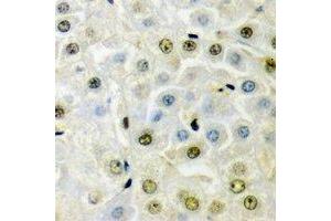 Immunohistochemical analysis of PRDM5 staining in mouse liver formalin fixed paraffin embedded tissue section. (PRDM5 抗体)