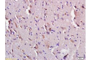 Formalin-fixed and paraffin embedded rat brain labeled with Anti-TMEM2L/KIAA1199 Polyclonal Antibody, Unconjugated (ABIN872432) at 1:200 followed by conjugation to the secondary antibody and DAB staining. (CEMIP 抗体  (AA 101-200))