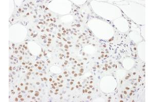 Immunohistochemistry (IHC) image for anti-Protein Kinase, DNA-Activated, Catalytic Polypeptide (PRKDC) (AA 4078-4128) antibody (ABIN7453431) (PRKDC 抗体  (AA 4078-4128))