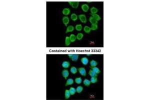 ICC/IF Image Immunofluorescence analysis of methanol-fixed A431, using RELT, antibody at 1:200 dilution. (RELT 抗体  (Center))