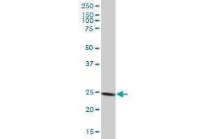 PSMA6 MaxPab polyclonal antibody. (PSMA6 抗体  (AA 1-246))