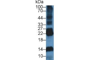 Western Blot; Sample: Rat Spleen lysate; ;Primary Ab: 1µg/ml Rabbit Anti-Rat DNASE1L2 Antibody;Second Ab: 0. (DNASE1L2 抗体  (AA 32-229))